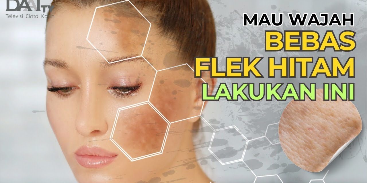 Rahasia Kulit Cerah Bebas Flek Hitam, Ini Langkah Yang Tepat