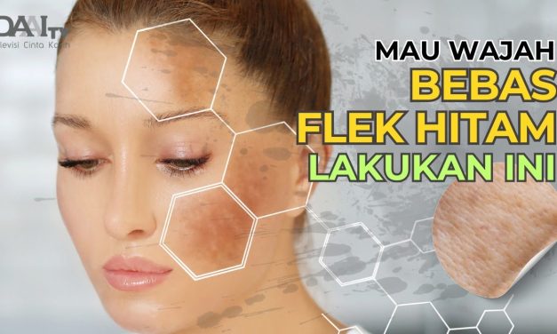 Rahasia Kulit Cerah Bebas Flek Hitam, Ini Langkah Yang Tepat